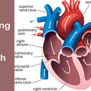 What is the Main Cause of a Heart Attack? What is its Solution?